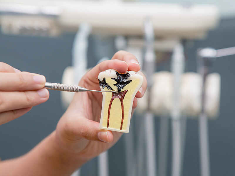 endodontia