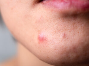 dermatologia
