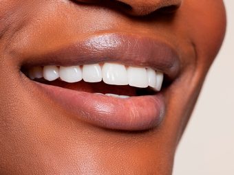 clareamento dental